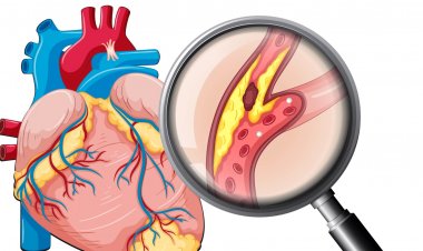 Giảm chiều cao là dấu hiệu của nguy cơ tử vong do đột quỵ và tim mạch